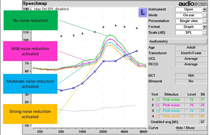 illustrates the reduction of gain by frequency at  four levels of noise reduction
