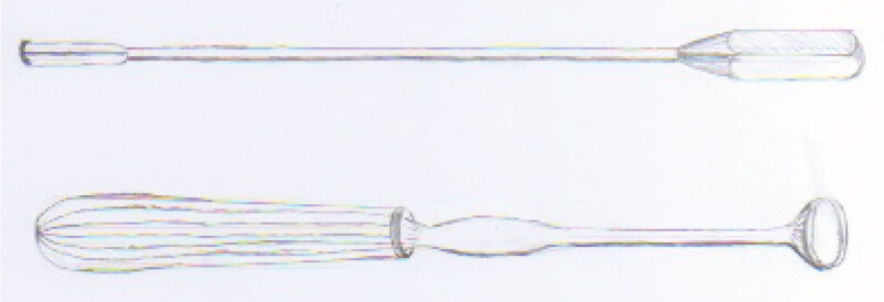 History of Adenoidectomy illustration