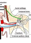 Three sound conduction pathways graphic
