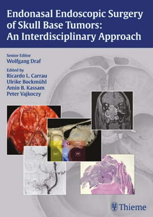 Endonasal Endoscopic Surgery of Skull Base Tumors: An Interdisciplinary Approach cover image