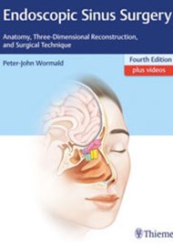 Endoscopic Sinus Surgery: Anatomy, Three-Dimensional Reconstruction and Surgical Technique - Fourth Edition cover image