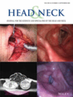 Head and Neck journal cover image.