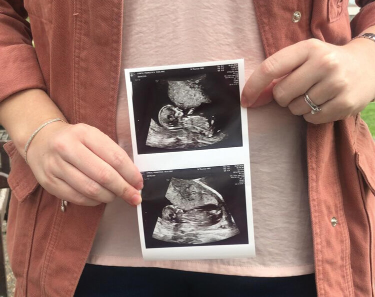 Photo of woman holding a pregnancy scan.