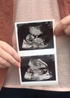 Photo of woman holding a pregnancy scan.