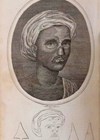 Photo showing an article in The Gentleman’s Magazine in 1794 described the operation of making  a nose from a forehead flap, accompanied by an engraving of the patient with the restored nose