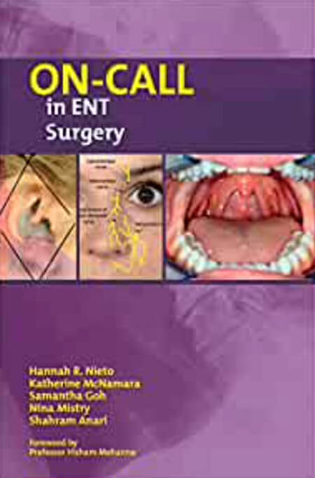 On-call in ENT Surgery book cover image.