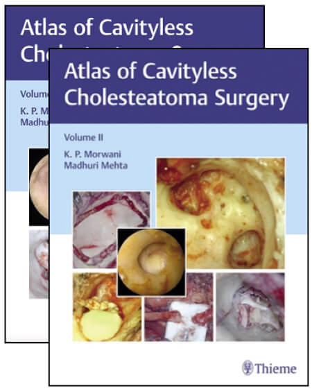 The Atlas of Cavityless Cholesteatoma Surgery: Volume I and II book cover image.