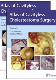 The Atlas of Cavityless Cholesteatoma Surgery: Volume I and II book cover image.