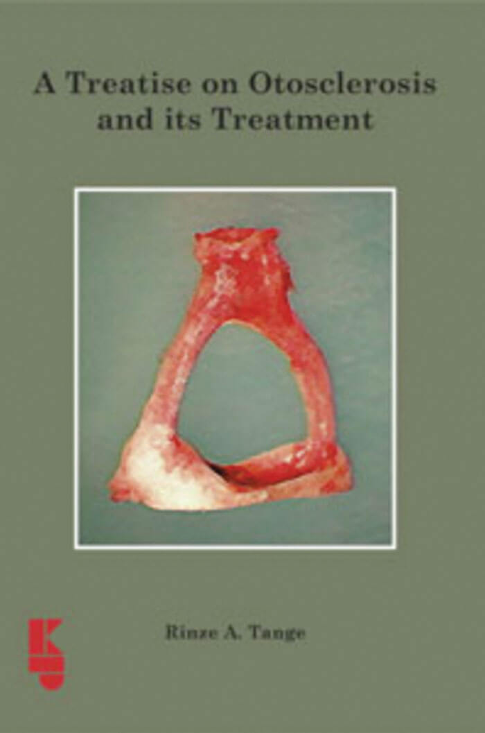 A Treatise on Otosclerosis and its Treatment book cover image.