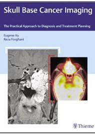 Skull Base Cancer Imaging: The Practical Approach to Diagnosis and Treatment Planning book cover image.
