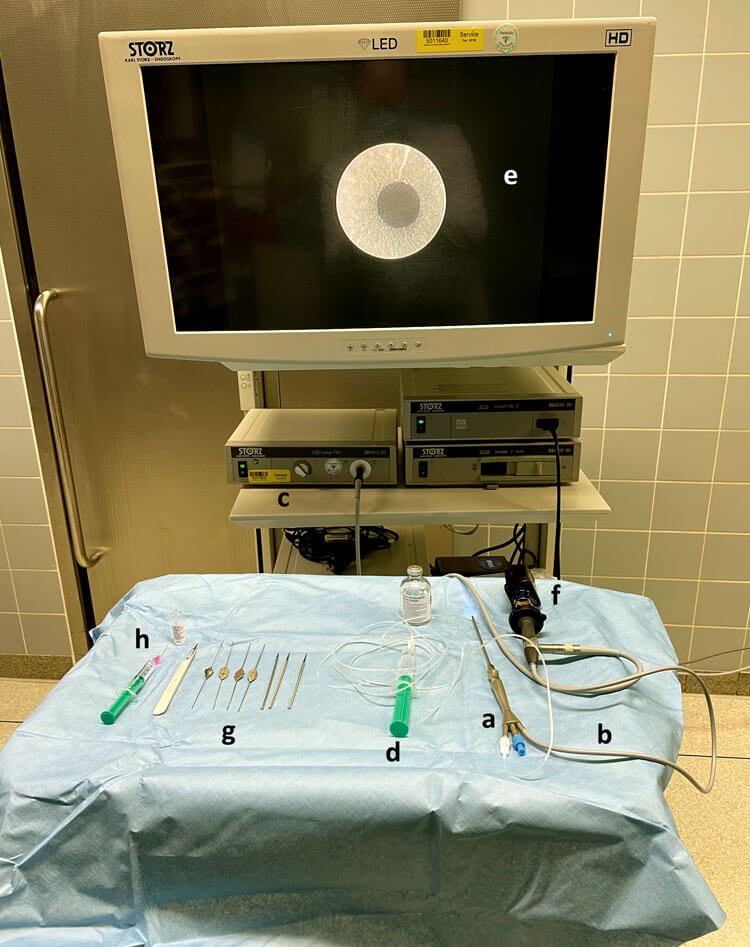 Photo showing basic setting for sialendoscopy.