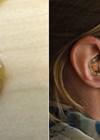 Photo showing examples of in-ear EEG mounts.