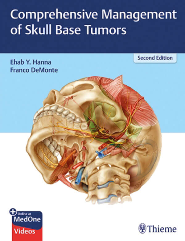 Comprehensive Management of Skull Base Tumors – Second Edition book cover image.