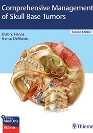 Comprehensive Management of Skull Base Tumors – Second Edition book cover image.
