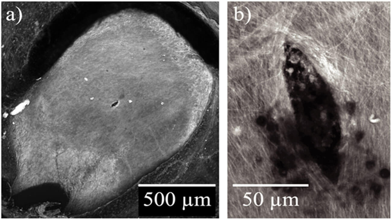 Confocal microscopy image of guinea pig RWM and higher magnification image near the perforation.