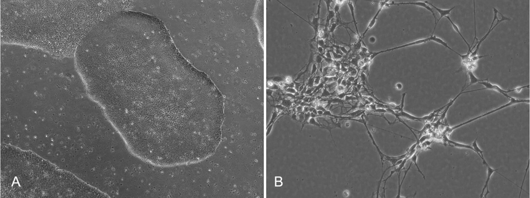 Image displaying undifferentiated, pluripotent stem cells. 
