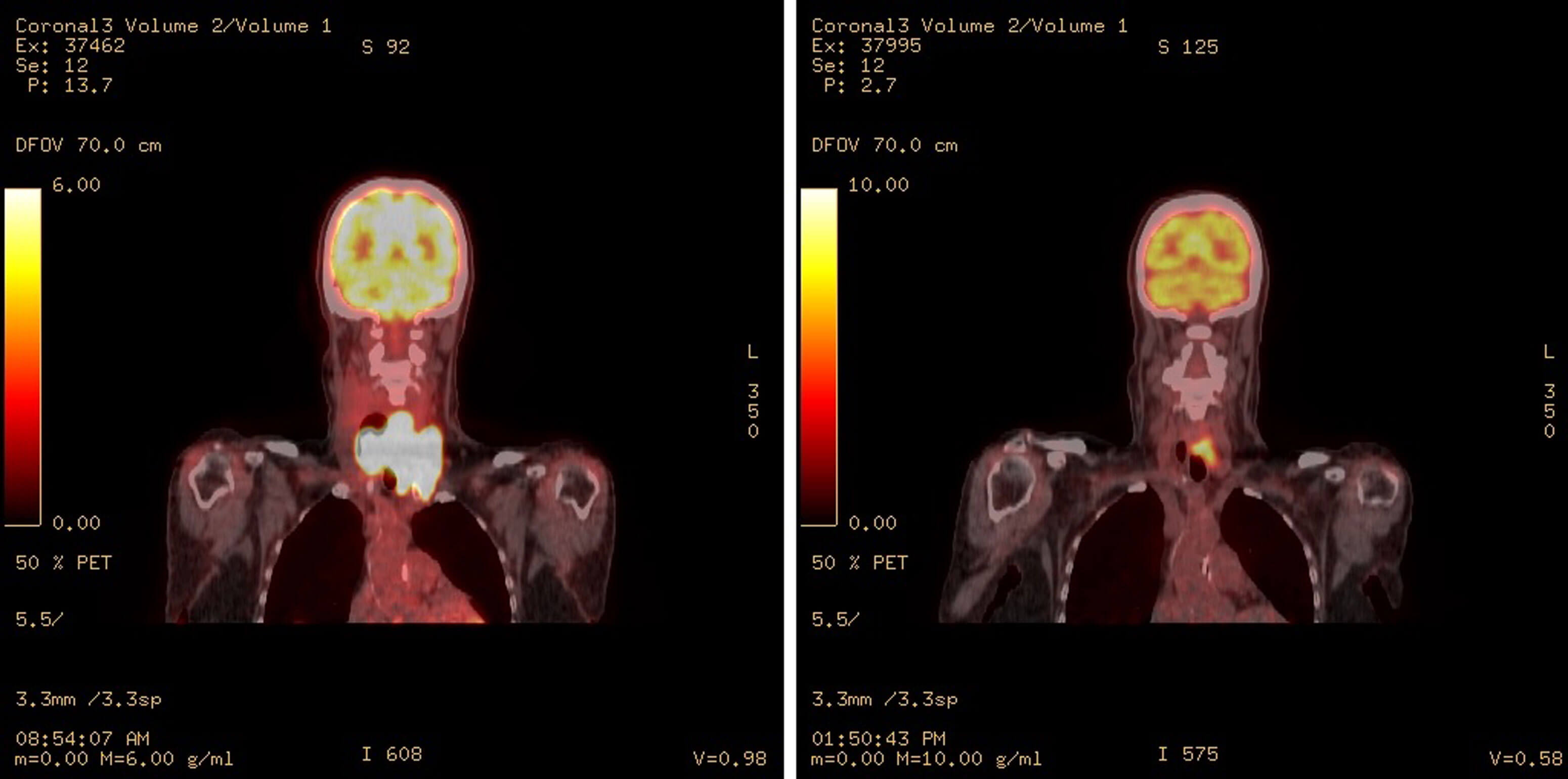 雑誌 - Thyroid Cancer Explore | メディカルレビュー社 書籍