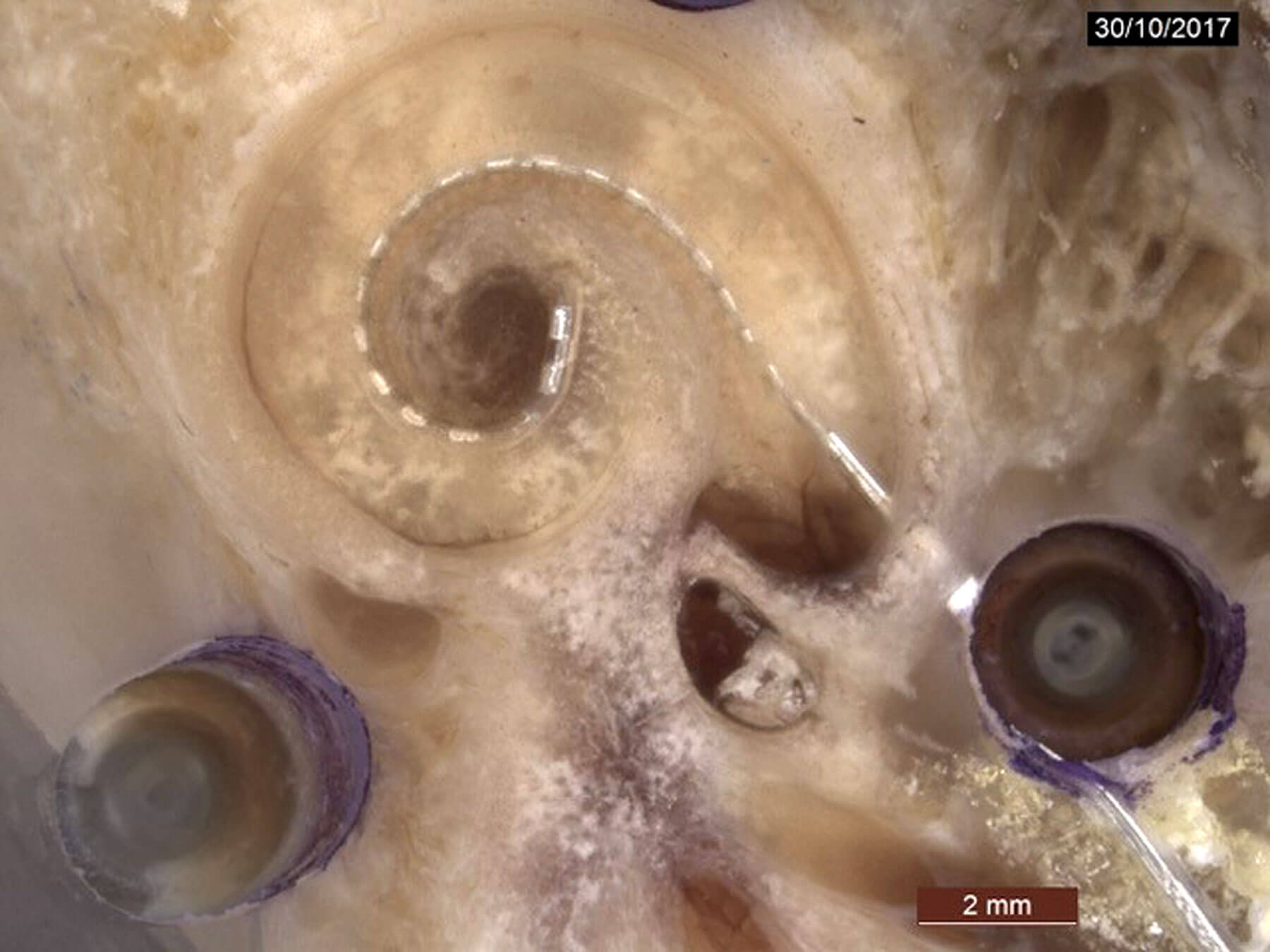 Image showing Cochlear implant array neural interphase.