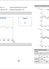 Graphs showing ANO: A. Preliminary programme, no P1 response to /G/ at 55 dB SPL. B. Modified programme, late latency P1 response to /M/ and /G/ at 55 dB SPL and /T/ at 65 dB SPL.