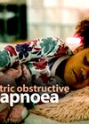 Paediatric obstructive sleep apnoea article image. 