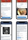 Photo showing MedShr’s ENT Group and example of case-based discussion with polling options.