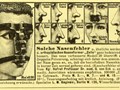 ENT-JF23-German-nose-corrector-1024x679.jpg