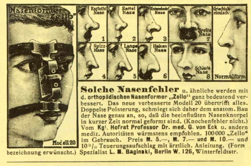 ENT-JF23-German-nose-corrector-1024x679.jpg