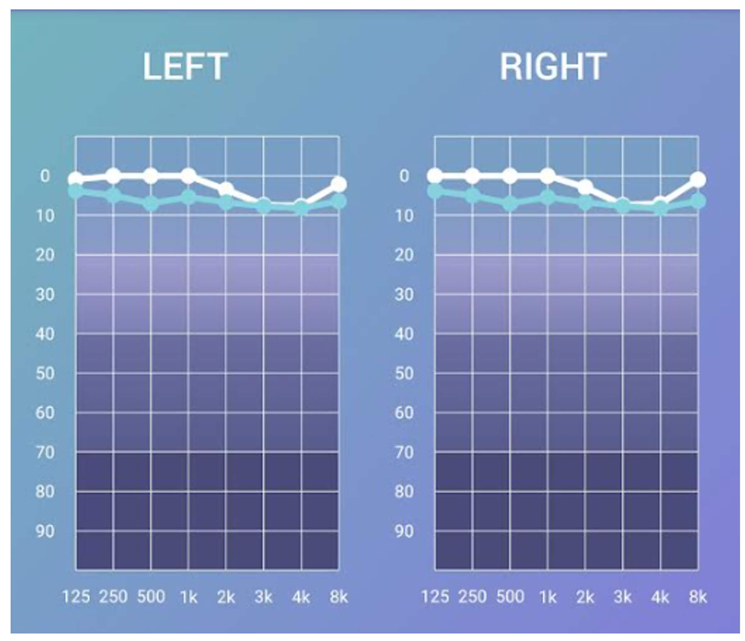 Image of Audiogram generated by Sennheiser Hearing Test app.
