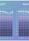 Image of Audiogram generated by Sennheiser Hearing Test app.