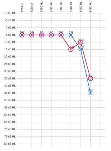 Hearing Test - Pure-tone audiometry on Android