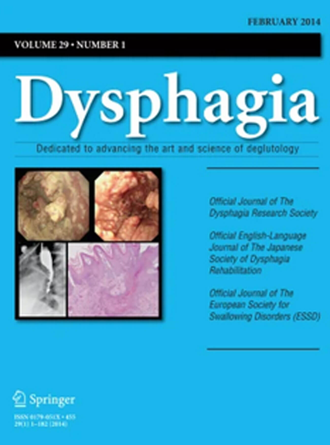 Dysphagia journal cover image.
