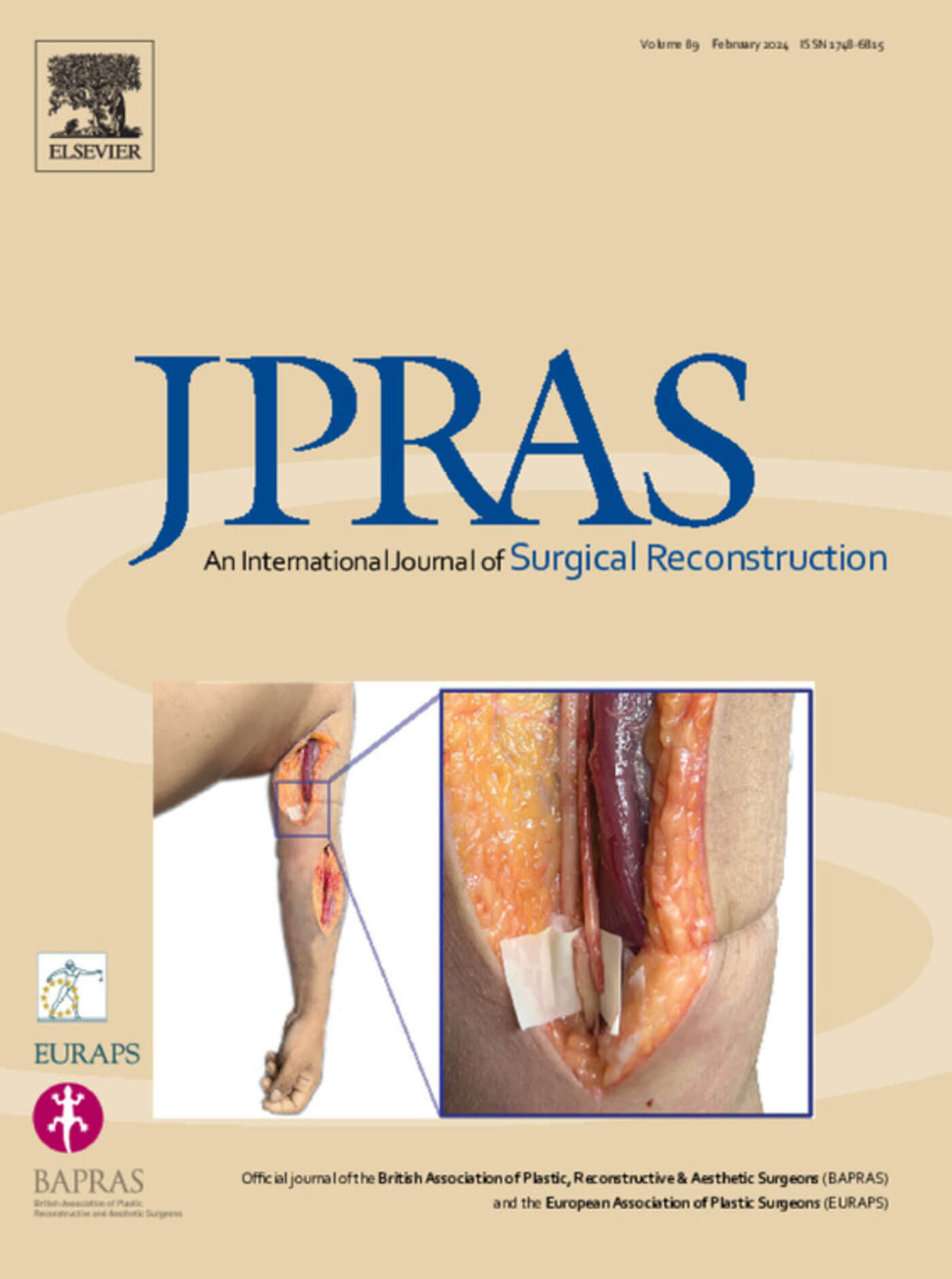 JPRAS journal cover image.