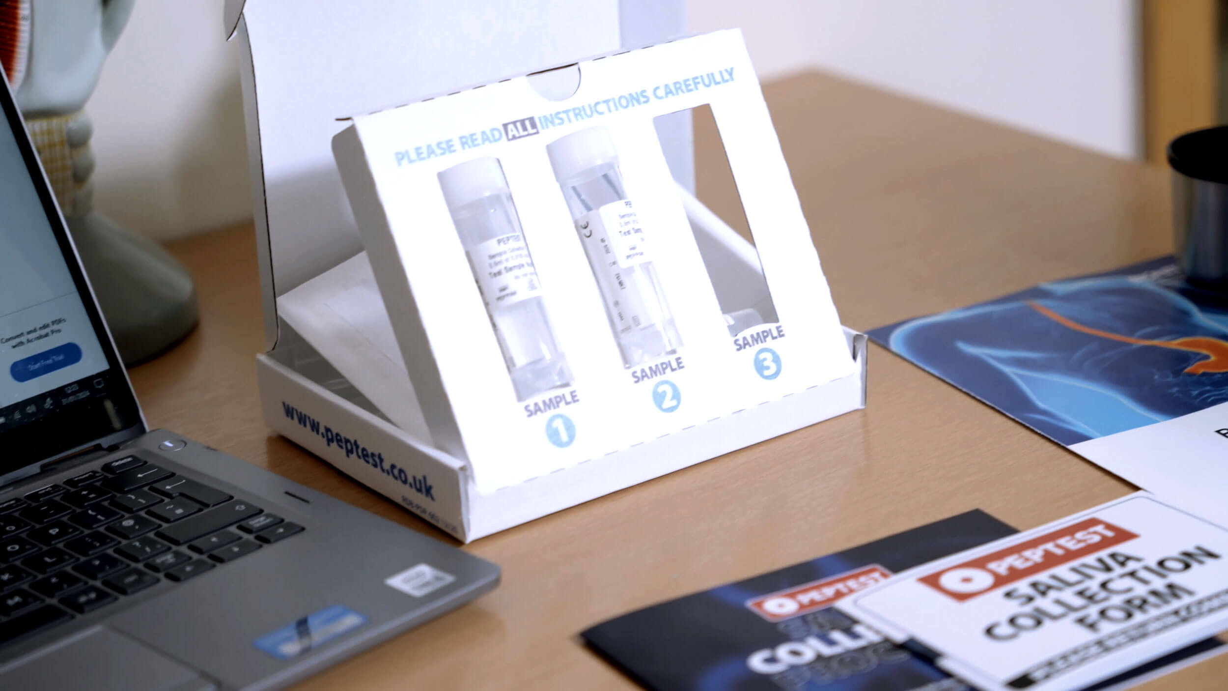 Photo showing Peptest equipment. 