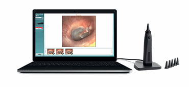 Viot™ – Video otoscope