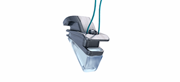 Vocal fold medialisation implant