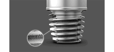 Ponto™ implant system