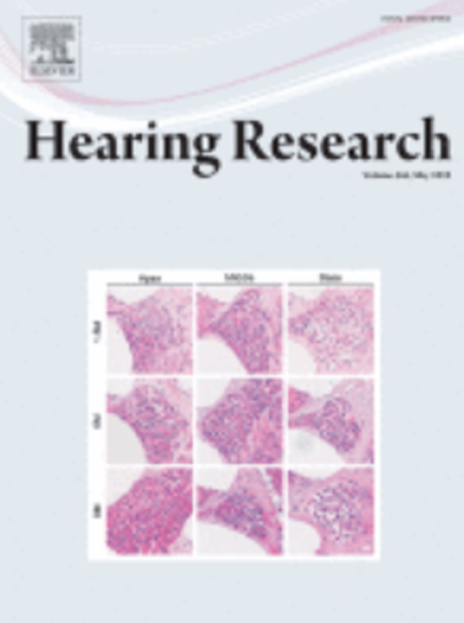 Hearing Research journal cover image.