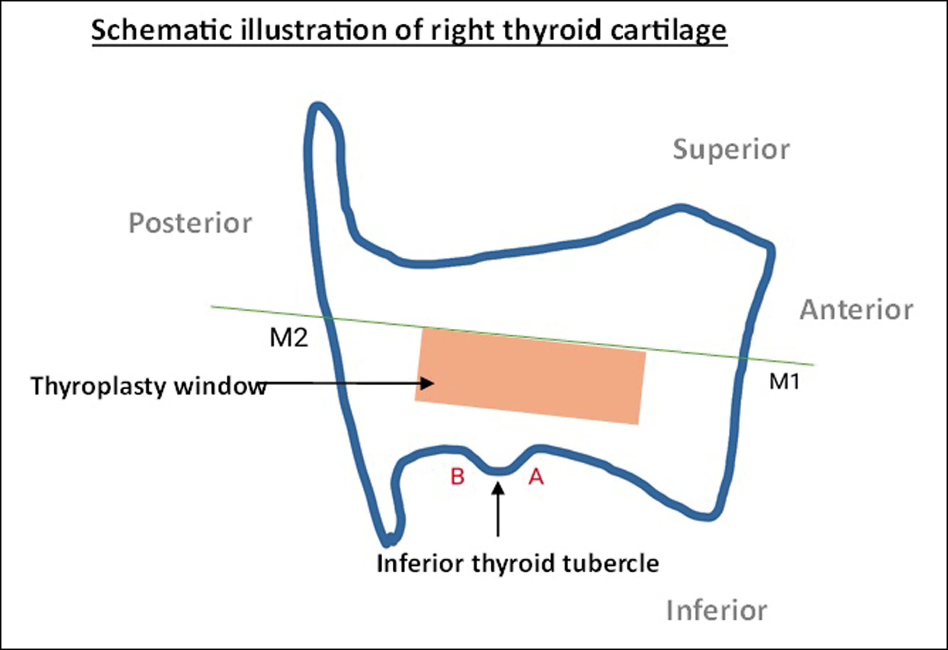Illustration showing window marking and allocation of key points.