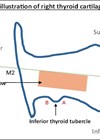 Illustration showing window marking and allocation of key points.