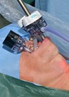 Photo showing placement of the ports.