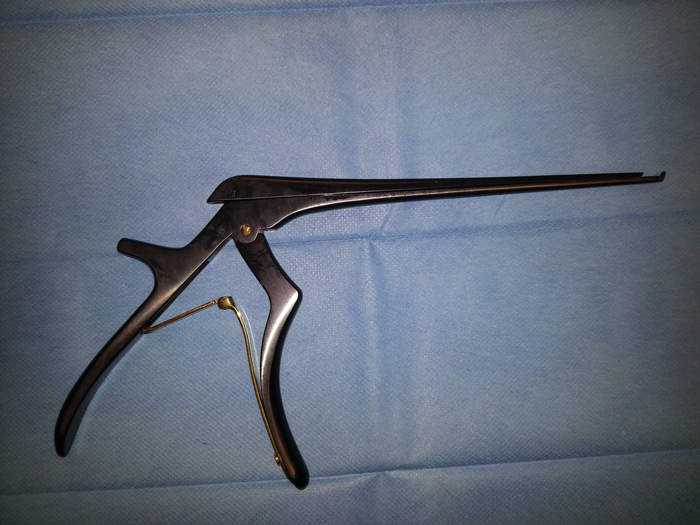 Endoscopic Dacryocystorhinostomy ENT & Audiology News