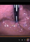Screenshot of TNO procedure video.