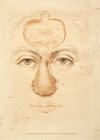 Image showing hand-coloured engraving by Charles Turner of a successful nasal operation in an Indian Army Officer.