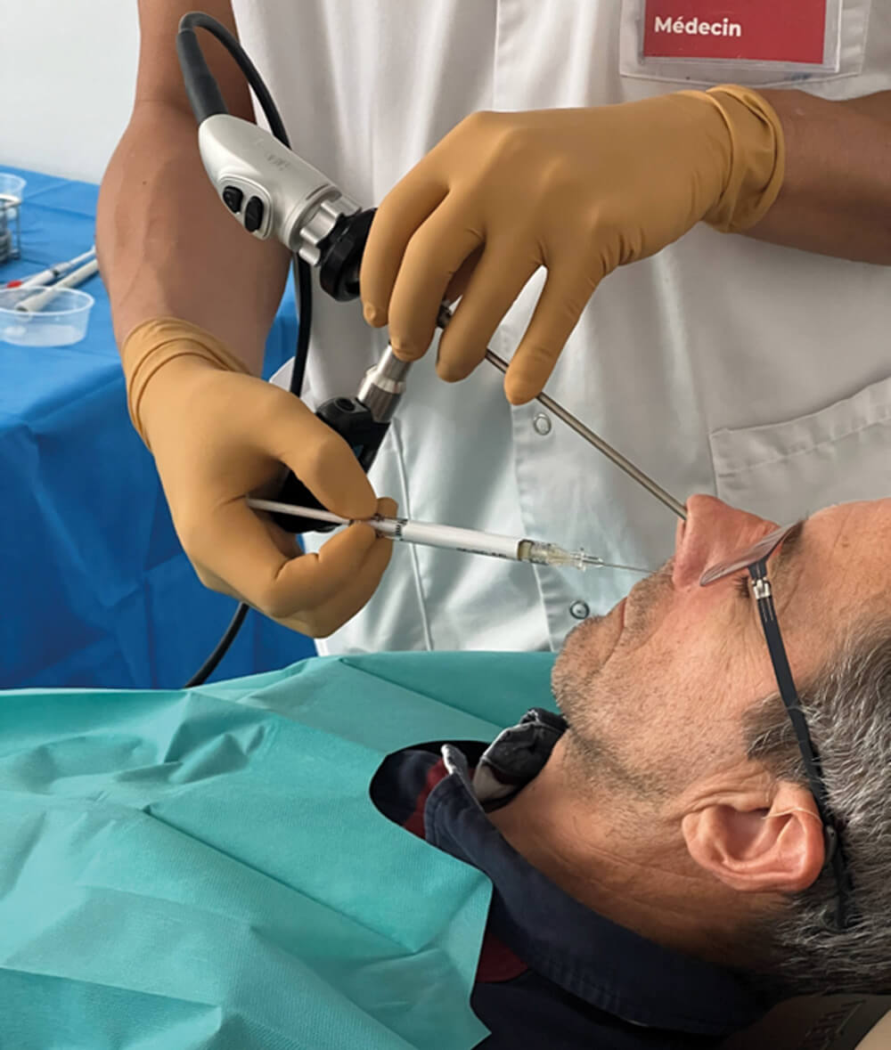 Photo showing intranasal injection performed under local anaesthesia.