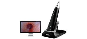 Wireless HD Otoscope