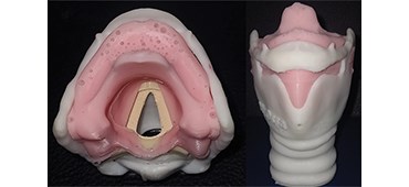 3D Larynx model
