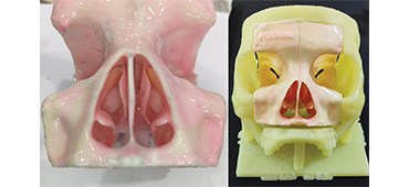 3D Paranasal Sinus Model