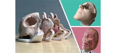 3D Surgical Models
