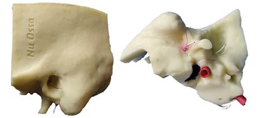 3D Temporal Bone Model
