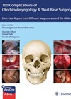 100 Complications of Otorhinolaryngology & Skull Base Surgery book cover image.